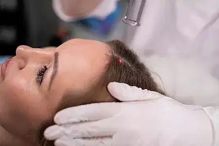 Стимуляция роста волос