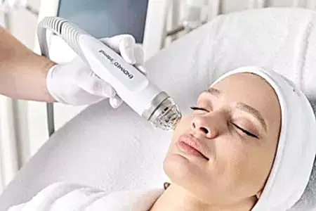 RF-лифтинг лица