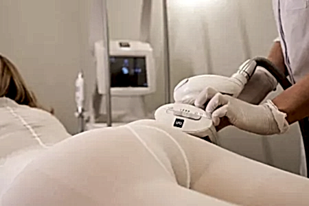 LPG-массаж тела